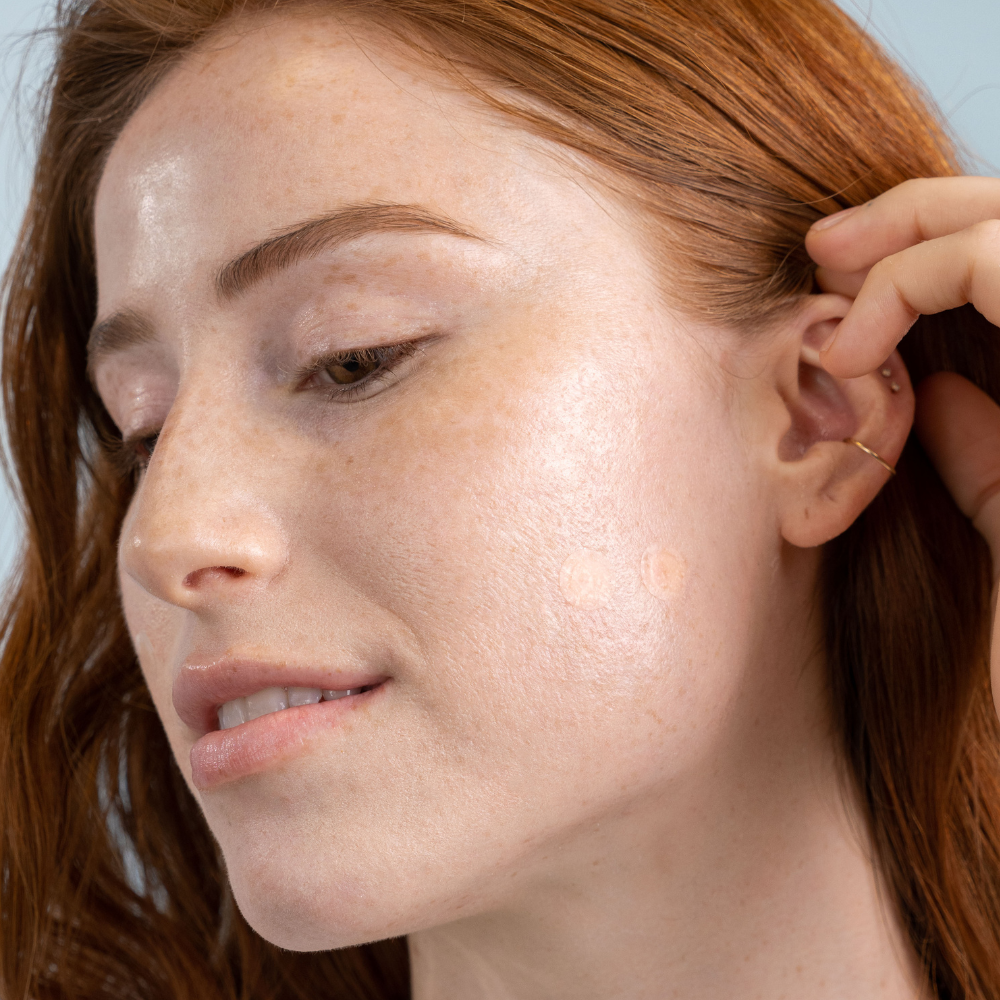 Derma Dot Invisible Pimple Patches- Clean Skin Club